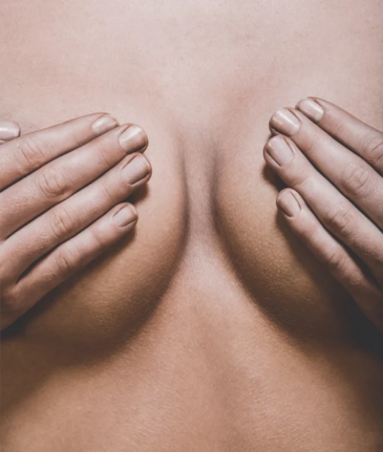 Breasts symmetrisation